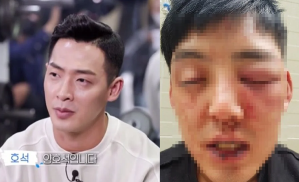 폭행 전과 고백했는데 오히려 박수받은 방송 출연자
