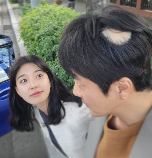 권상우, 벌써 원형탈모? 휑한 정수리에 팬들 '깜짝'
