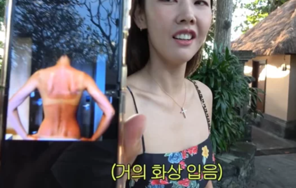 한혜진 상반신이 온통 빨갛게…발리에서 무슨 일?